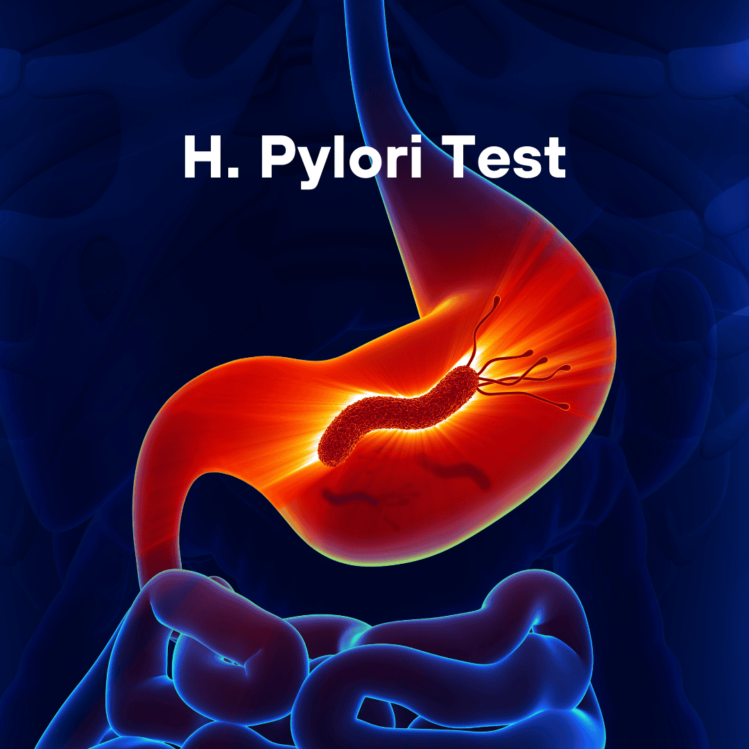Helicobacter Pylori H Pylori Infection Test Sova Health Helicobacter Pylori H Pylori Infection Test Sova Health
