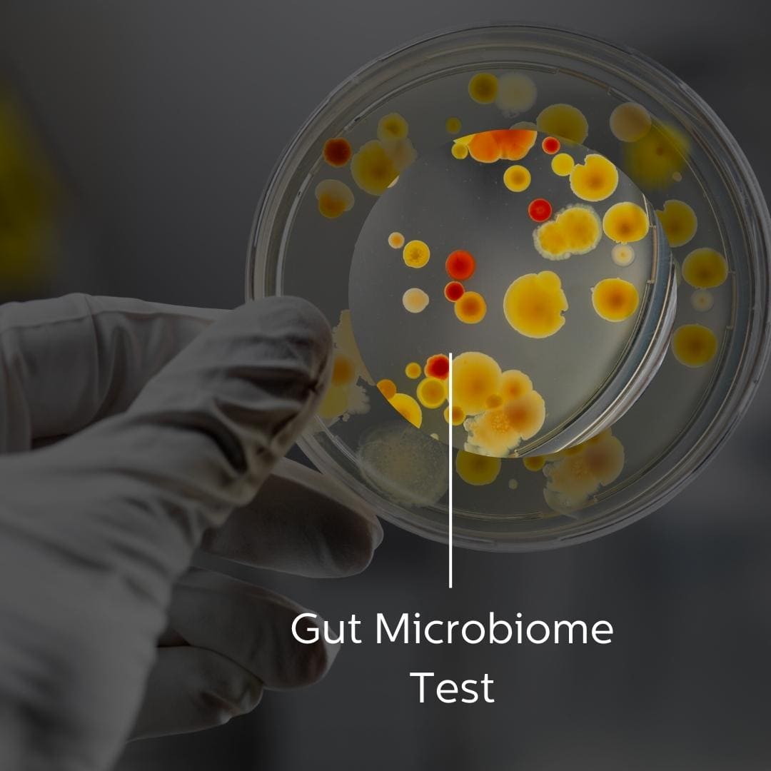 India's Most Advanced Gut Microbiome Test